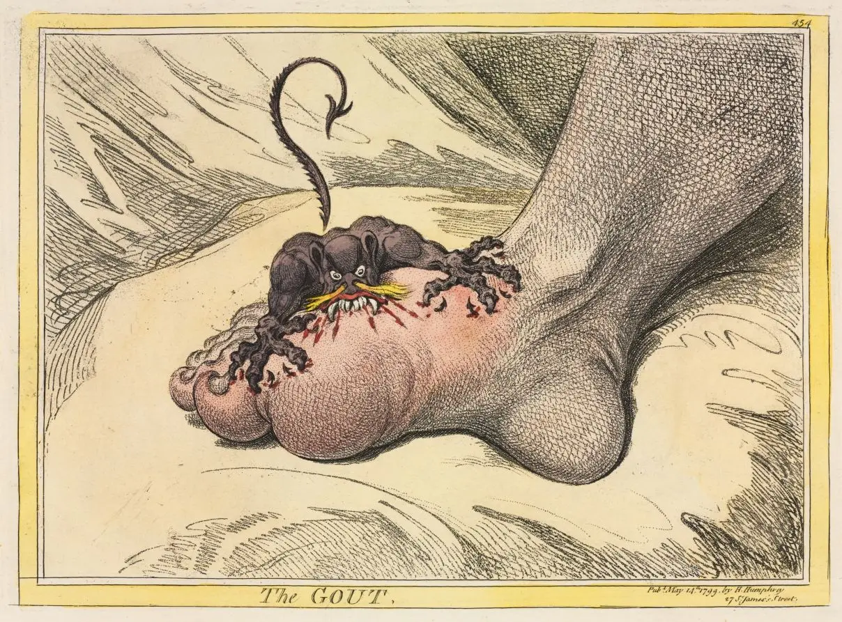 The Gout by James Gillray