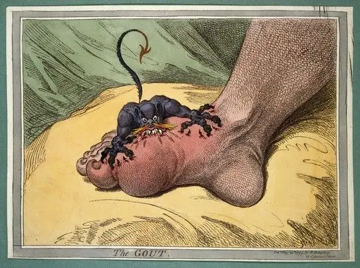 James Gillray, 'The Gout' by James Gillray