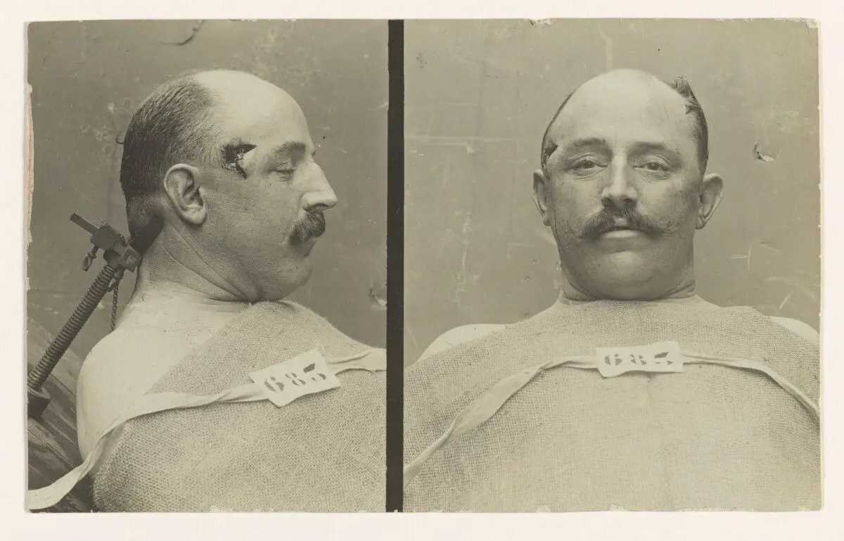 [Two views of a man] by Alphonse Bertillon