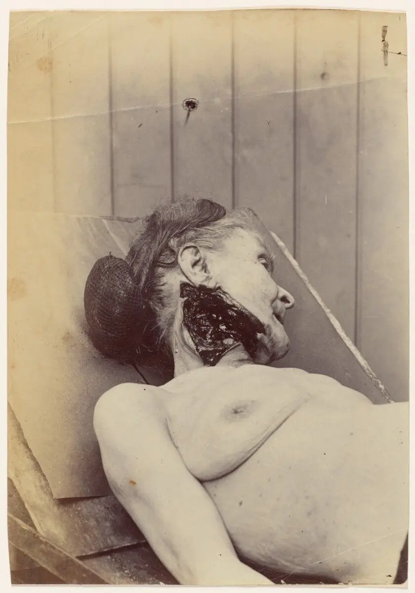 Baronne Dellard (Victime d’Anastay) by Alphonse Bertillon