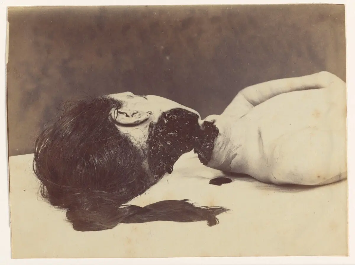 Marie Gremeret (fille de la bonne) by Alphonse Bertillon