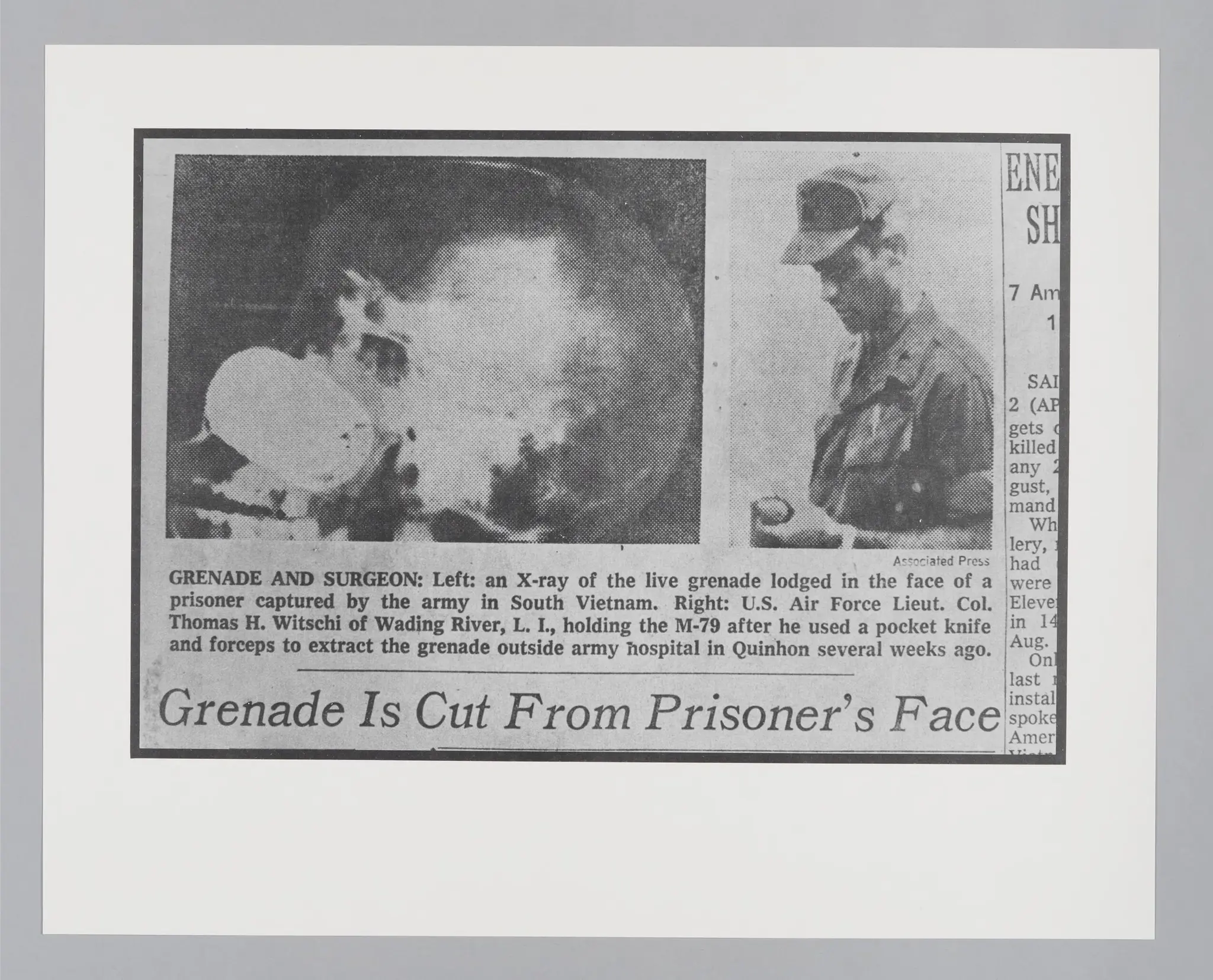 Untitled ("Grenade is Cut from Prisoner's Face") by Donald Blumberg