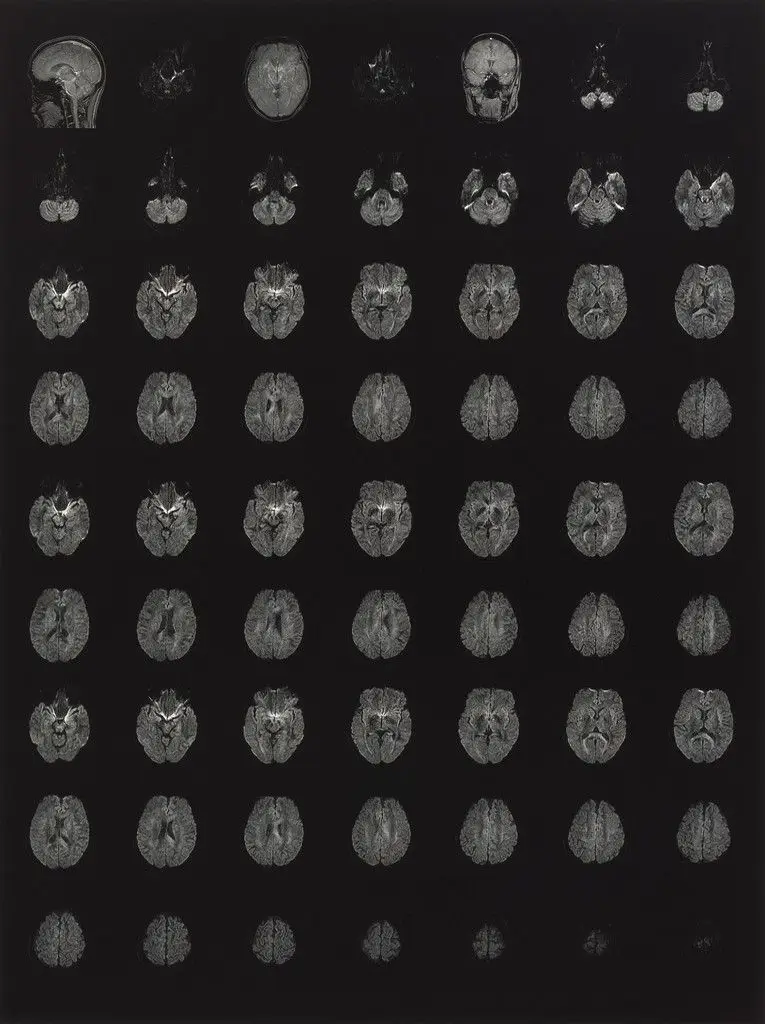 Big Nude II by Heji Shin