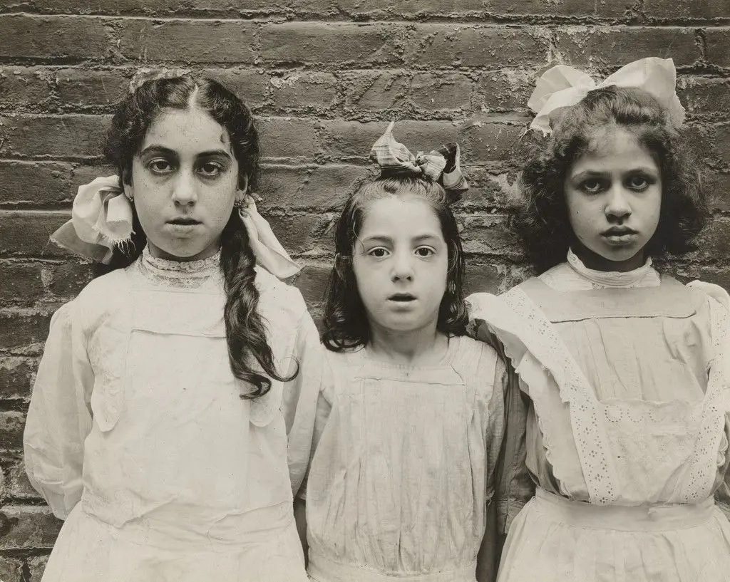 Physically Defective Children by Jessie Tarbox Beals