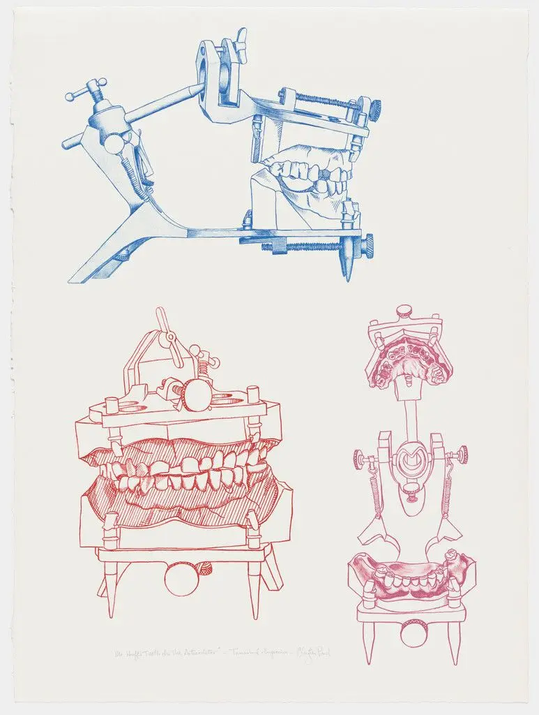 Mr. Huff's Teeth in the Articulator by Clayton Pond