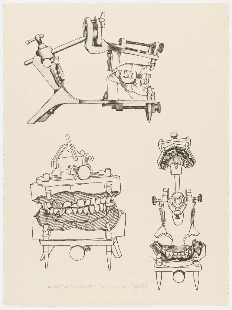 Mr. Huff's Teeth in the Articulator by Clayton Pond
