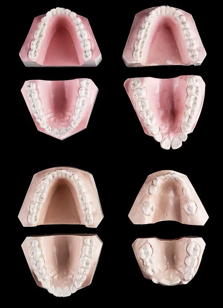 Model Teeth by circa 1940