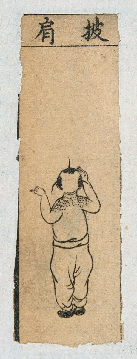 Mid C20 Chinese medical illustration in trad. style: Smallpox by Unknown artist