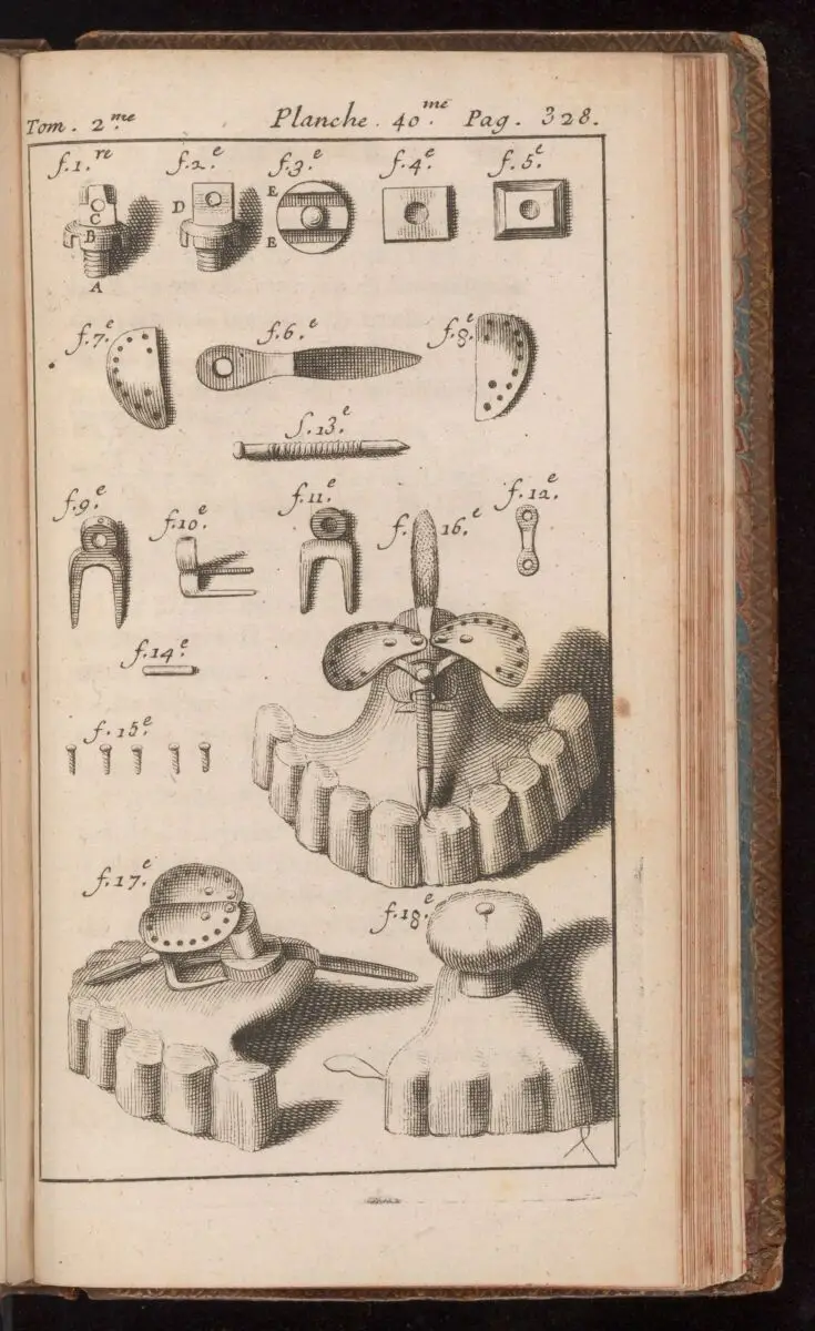 Dental tools used in dental prosthesis, P. Fauchard, 1728. by Unknown artist