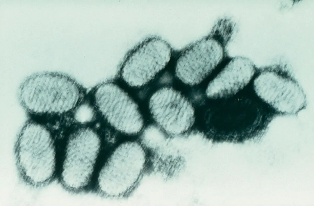 Orf virus under electron microscope by ROYAL VETERINARY COLLEGE
