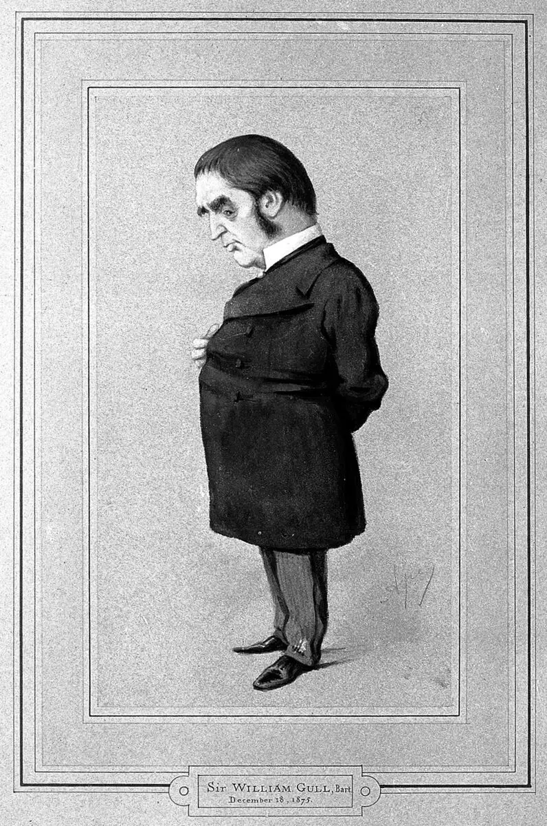 Portrait of Sir William W. Gull, caricature by Unknown artist