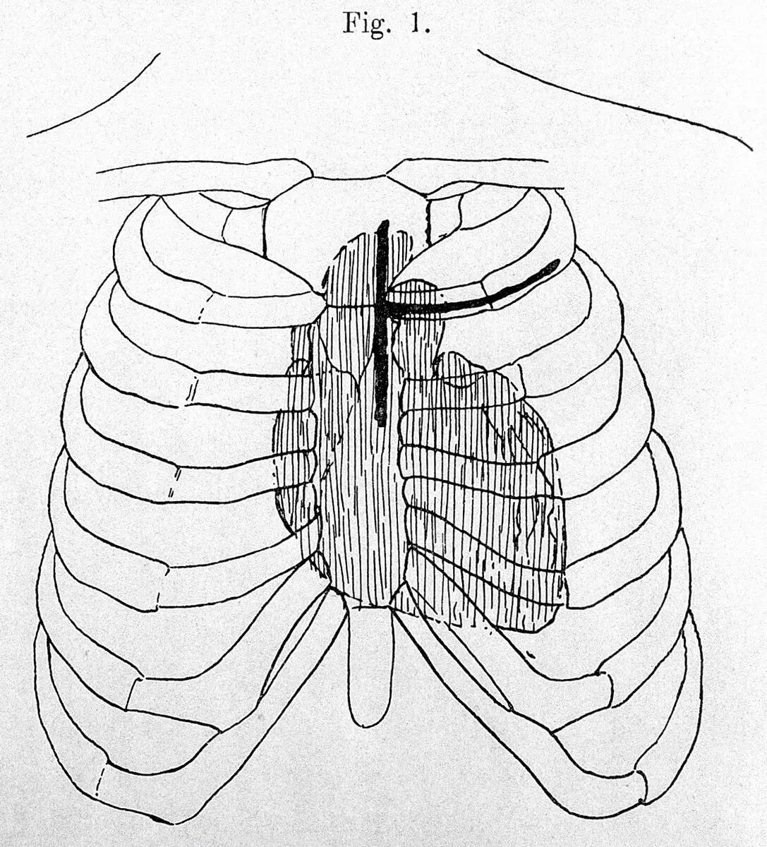 Thoracic surgery. by Unknown artist